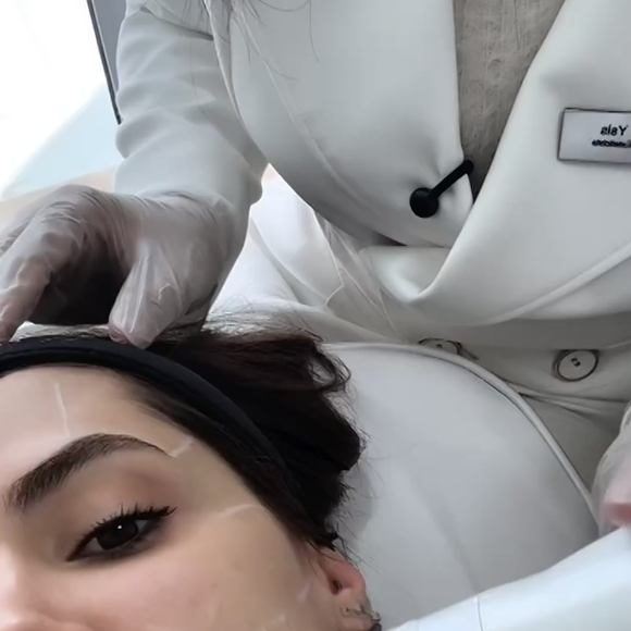 De acordo com a especialista, a técnica combina ultrassom microfocado com a radiofrequência monopolar, duas tecnologias queridinhas das famosas