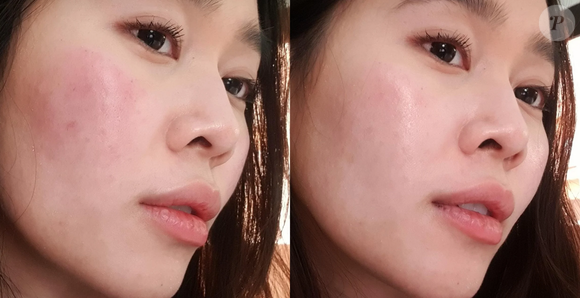 O creme Ciclapast é um creme reparador e cicatrizante usado para tratar pele irritada, queimaduras superficiais, para regenerar a pele após tratamentos médicos, assaduras ou cicatrizes causadas por diversos motivos.