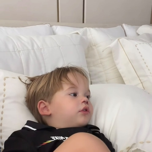 José Leonardo, de 2 anos, mostrou as marcas dos 5 pontos que levou no nariz após acidente em casa