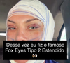 Andressa Urach revelou ter feito um Fox Eyes Tipo 2 Estendido, combinado com uma blefaroplastia