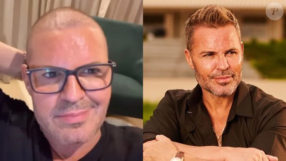 O cantor Eduardo Costa assumiu que o uso de anabolizantes acentuou sua queda de cabelo. Então, fez o transplante recentemente