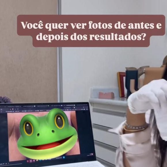 Mãe de Vanessa Lopes postou o antes e depois da vagina após passar por cirurgia íntima