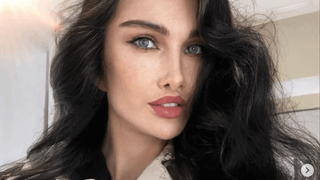 'Minha mãe me abandonou em uma fazenda e desapareceu. Eu sofria de anorexia e bulimia e pesava 38 quilos. Meu rosto ficou paralisado por causa de preenchimentos'