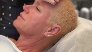 'Tão eficaz quanto o Minoxidil': dermatologista revela 'superpoder' do óleo de alecrim em alopécia, doença revelada por Xuxa, Juliette e + famosas