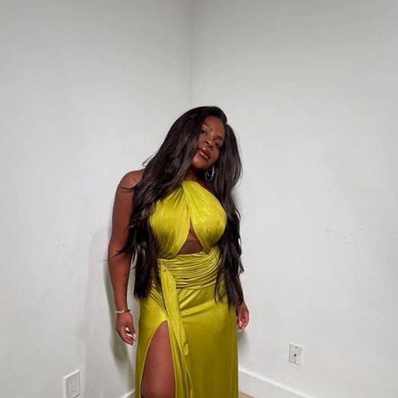 Jojo Todynho agora passou por um lifting nas pernas