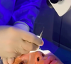 Cirurgia de Maya Massafera é conhecida como 'tatuagem da córnea' e foi realizada em um centro especializado