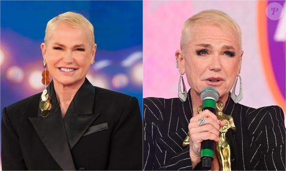 Xuxa durante evolução após o transplante capilar