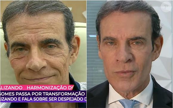 Mário Gomes teve o rosto transformado graças ao programa 'Fofocalizando', do SBT