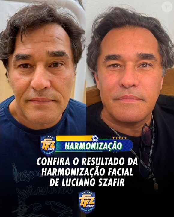 A revelação de seu 'antes e depois' foi feita no programa Fofocalizando do SBT