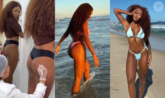 Muitos não sabem, mas antes da final do 'BBB 25' Giovanna Jacobina, irmã de Gracyanne, fez harmonização no bumbum