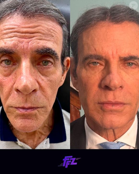 Antes e depois de Mário Gomes surpreendeu a web e rendeu elogios para o ator de 72 anos