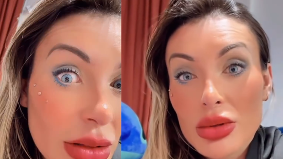 Após Andressa Urach demonstrar arrependimento de cirurgia para mudar cor do olho, médico alerta: procedimento pode causar cegueira