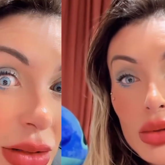 Após Andressa Urach demonstrar arrependimento de cirurgia para mudar cor do olho, médico alerta: procedimento pode causar cegueira