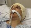 Renee Murdoch foi internada em estado crítico no Hospital Miguel Couto, no Rio