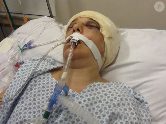 Renee Murdoch foi internada em estado crítico no Hospital Miguel Couto, no Rio