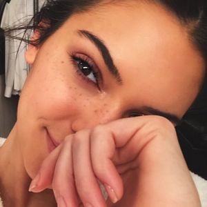 Por trás das superproduções de Kendall Jenner se escondem sardas muito charmosas