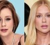Marina Ruy Barbosa mudou o rosto com procedimentos estéticos? Especialista analisa antes e depois e lista retoques: nariz, boca, mento e mais!