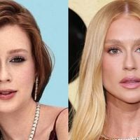 Marina Ruy Barbosa mudou o rosto com procedimentos estéticos? Especialista analisa antes e depois e lista retoques: nariz, boca, mento e mais!