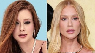 Marina Ruy Barbosa mudou o rosto com procedimentos estéticos? Especialista analisa antes e depois e lista retoques: nariz, boca, mento e mais!