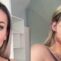 Como está Andressa Urach após nova plástica de R$ 100 mil? Com a cabeça enfaixada, influenciadora mostra rosto com pontos: 'Fiz o famoso...'