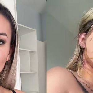 Como está Andressa Urach após nova plástica de R$ 100 mil? Influenciadora mostra rosto com pontos: 'Fiz o famoso...'