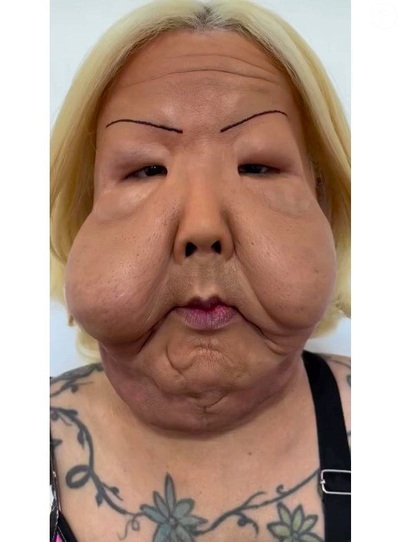 Juju do Pix apareceu em imagens divulgadas pelo médico antes do procedimento