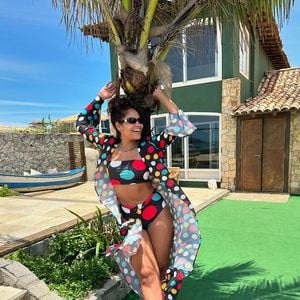 Para lidar com o lipedema, Barbara Reis começou uma dieta anti-inflamatória sem açúcar e farinha