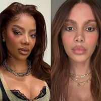 Como eram estas 20 famosas antes de conhecer o cirurgião plástico? Antes e depois é chocante