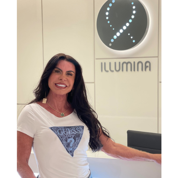 Depois do procedimento, Gretchen ganhou uma chuva de elogios por ter mudado seu rosto