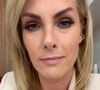 Ana Hickmann terá que pagar a chamada pensão compensatória para Alexandre Correa