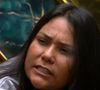 Sem filtros, Chaiany Andrade conquistou o público ao mostrar sua rotina e a realidade da pele acneica no 'BBB 26'.