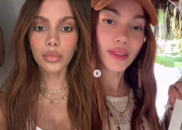 Anitta mexeu no nariz, de novo? Web aponta nova rinoplastia e mudança no rosto da cantora após fotos e vídeos com a xamã Max Tovar.