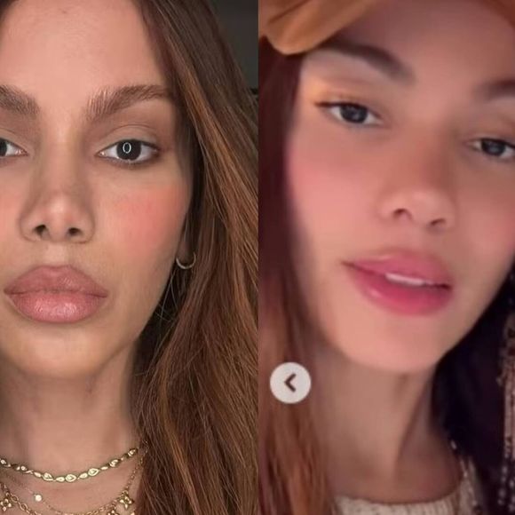 Anitta mexeu no nariz, de novo? Web aponta nova rinoplastia e mudança no rosto da cantora após fotos e vídeos com a xamã Max Tovar.